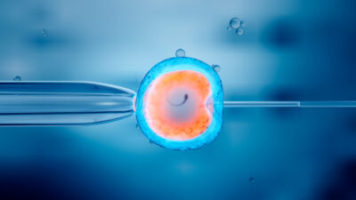 Photo by Christoph Burgstedt/Science Photo Library/Getty Images
