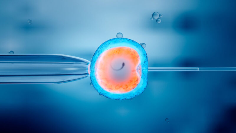 Photo by Christoph Burgstedt/Science Photo Library/Getty Images