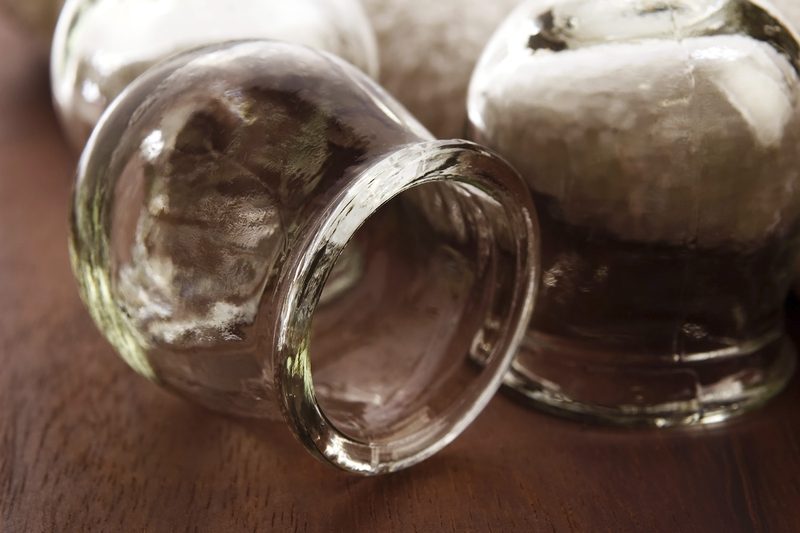 Can the ancient practice of cupping fix my very modern aches and pains?